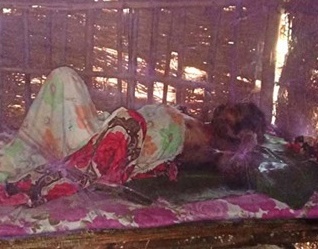 छालाको क्यान्सर पीडित सुरजको मृत्यु