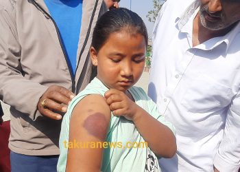 इटहरीमा होमवर्क नजानेको भन्दै छात्रामाथि निर्घात कुटपिट
