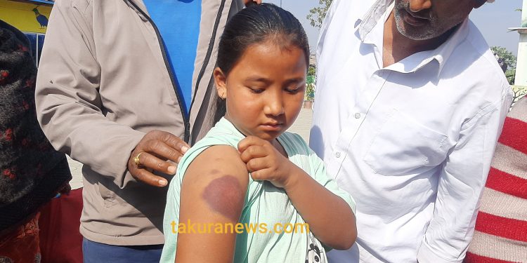 इटहरीमा होमवर्क नजानेको भन्दै छात्रामाथि निर्घात कुटपिट