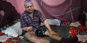 ‘बरु त्यसबेला ट्याक्टरले किचेरै मारिदिएको भए सकिजान्थ्यो, दशाले यस्तो बनायो…’