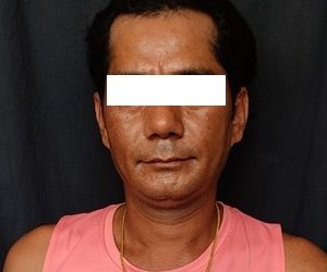 बाल यौन दुर्व्यवहार मुद्दाका फरार प्रतिवादी इटहरीका एक पुरुष पक्राउ