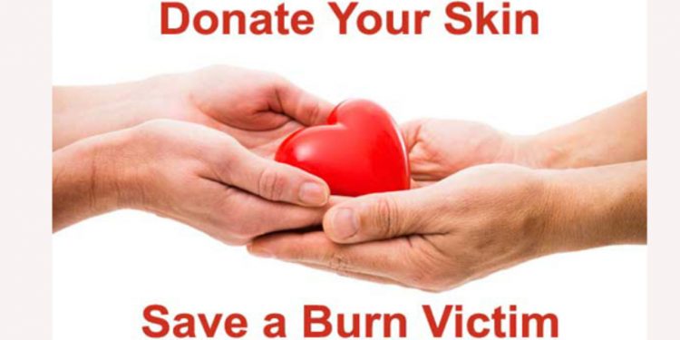 पूर्वमा १ सय ४ जनाद्धारा छालादान गर्ने घोषणा, के हो छालादान ?