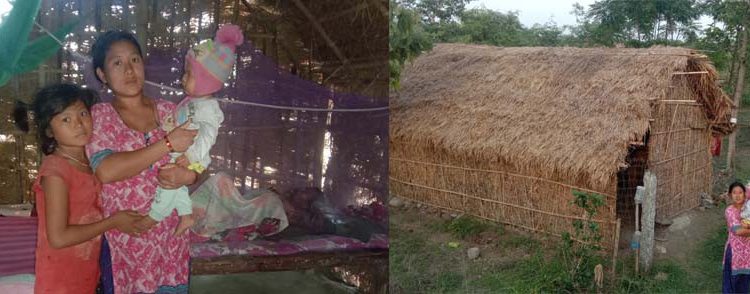 छालाको क्यान्सर भएका इटहरीका सुरजको चीत्कार