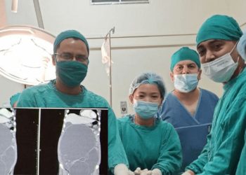 बीपी प्रतिष्ठानमा १८.६ किलोको ट्युमर शल्यक्रिया गरी निकालियो