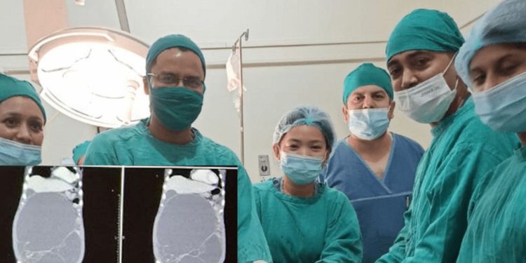 बीपी प्रतिष्ठानमा १८.६ किलोको ट्युमर शल्यक्रिया गरी निकालियो