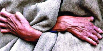 झापामा ६ महिनामै ५५ जना कुष्ठरोगी फेला